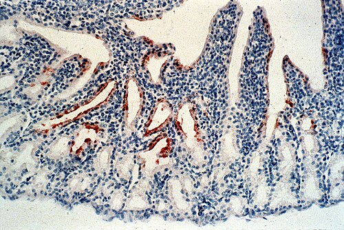 Newcastle disease: sick poultry showing respiratory symptoms